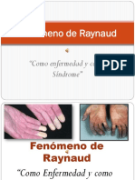 Fenómeno de Raynaud