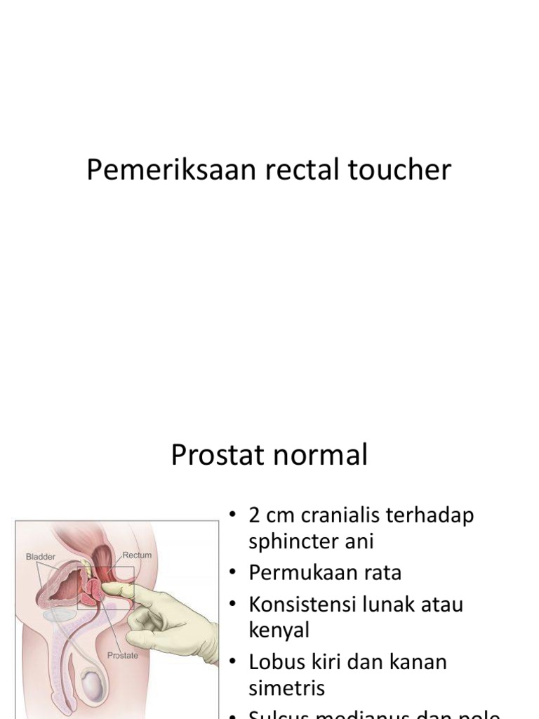 Interpretasi Pemeriksaan Rectal Touche | PDF