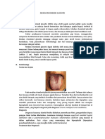 Median Rhomboid Glossitis