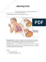 Bronquitis: causas, síntomas y tratamiento de la inflamación de los bronquios