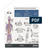 Ejercicios Para La Escoliosis