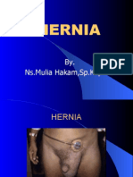 Hernia