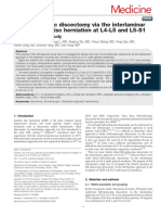 Medicine: Full-Endoscopic Discectomy Via The Interlaminar Approach For Disc Herniation at L4-L5 and L5-S1