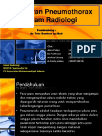 Gambaran Pneumothorax Dalam Radiologi