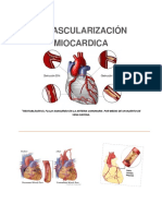 revascularizacion miocardica 2