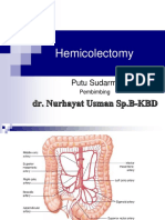 Teknik Operasi Hemicolectomy