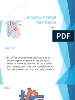 Conducto Arterial Persistente