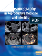 Ultrasound Use For Female Fertility