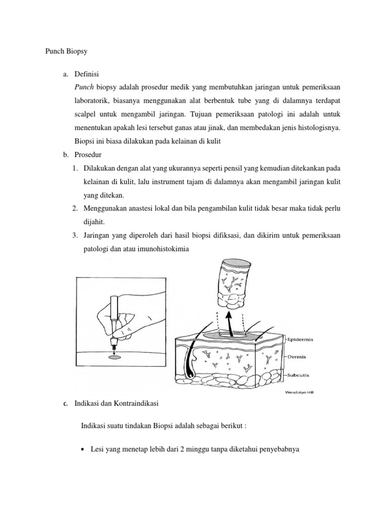 Punch Biopsy PDF