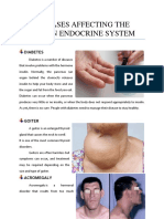 Endocrine Diseases: Diabetes, Goiter, Acromegaly, Cushing, Hypopituitarism