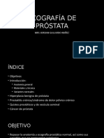 Ecografía de Próstata