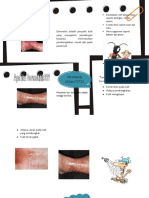 Leaflet Dermatitis