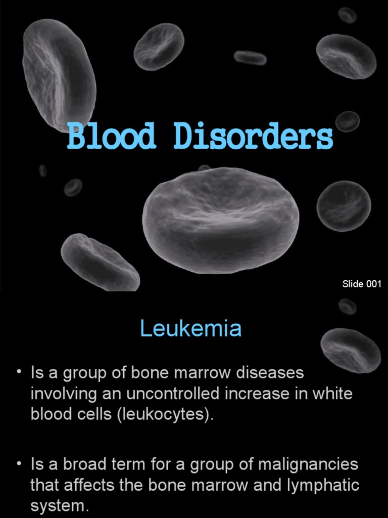 Blood Disorders - Leukemia | PDF | Medical Specialties | Leukemia