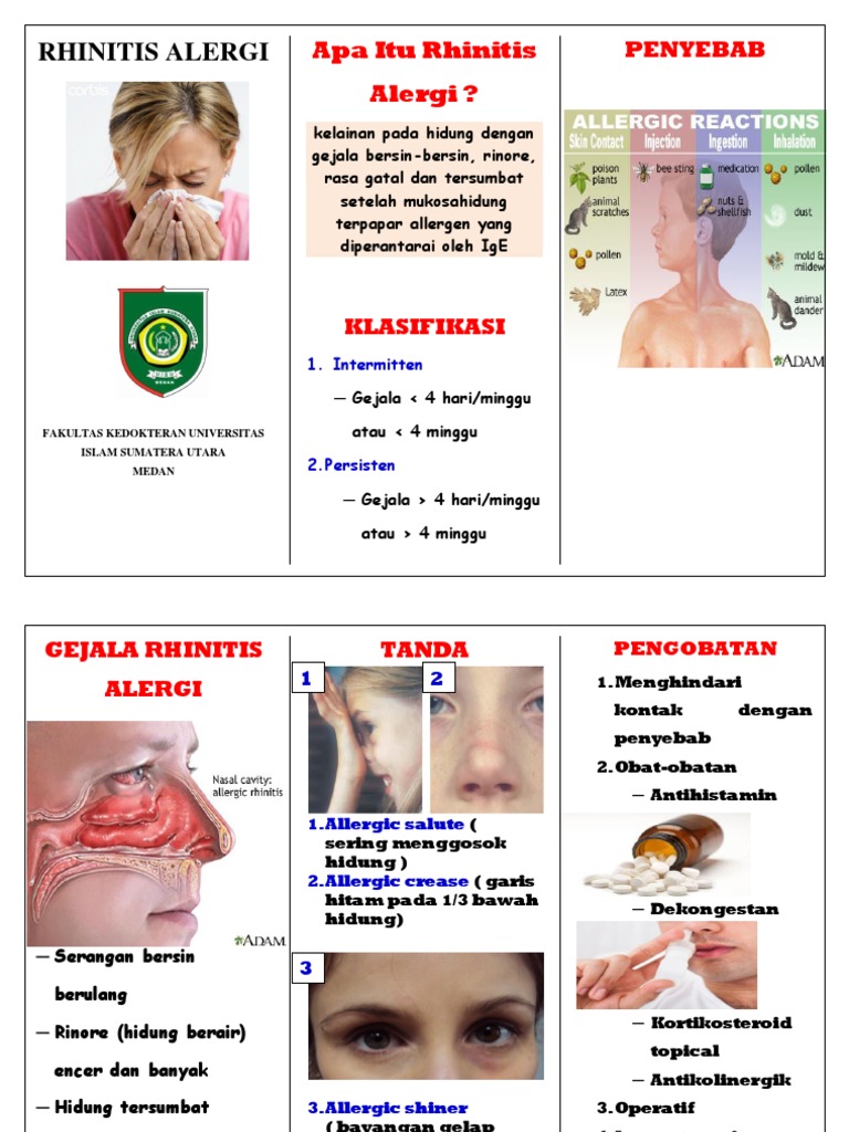 Rhinitis Alergi | PDF