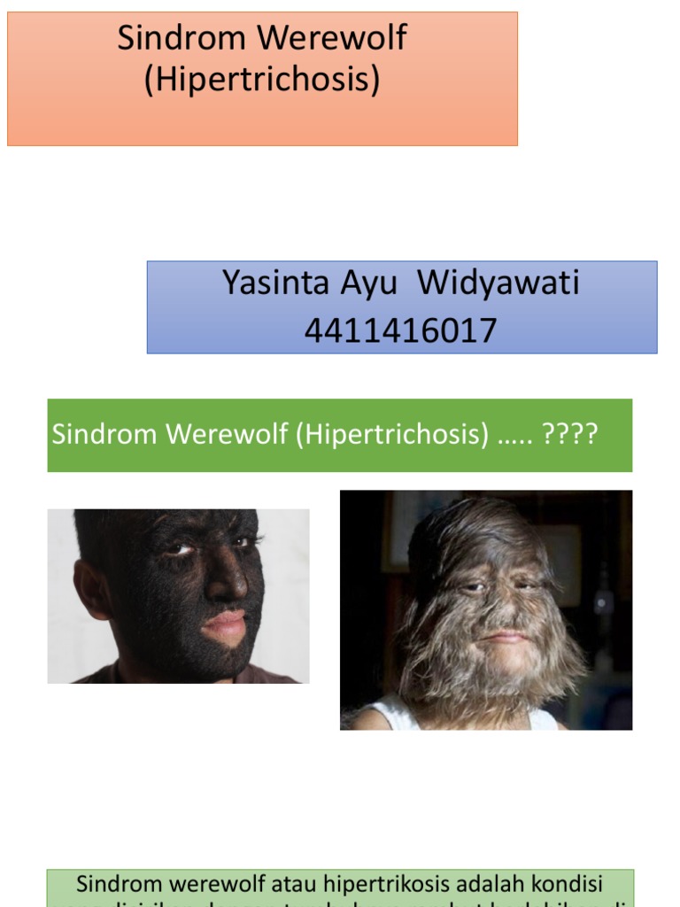 Sindrom Werewolf (Hipertrichosis) BIONUTRISIII | PDF | Kesehatan ...