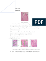 Patogenesis Gingivitis