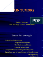 Tumor Otak dan Neuroglia