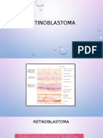 Referat Retinoblastoma