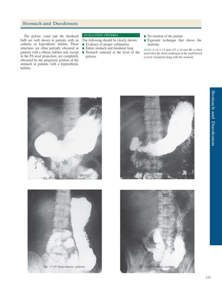 Stomach and Duodenum Imaging Guidelines | PDF
