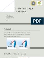 Trikiasis & Benda Asing Konjungtiva222222