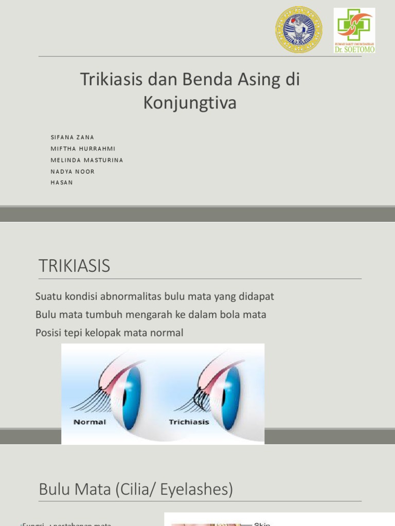 Trikiasis & Benda Asing Konjungtiva222222 | PDF