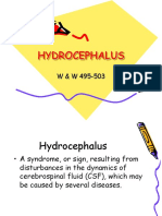 HYDROCEPHALUS_2