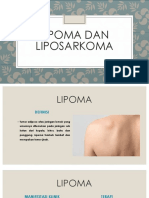 Lipoma & Liposarkoma