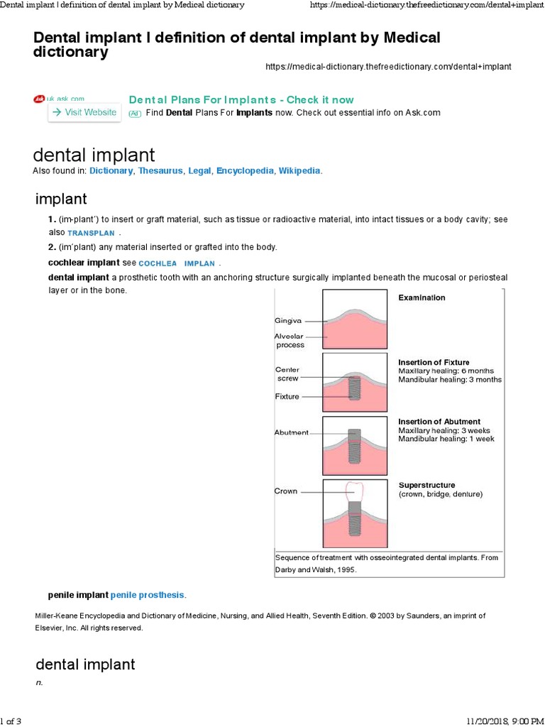 4. Dental Implant Definition of Dental Implant by Medical Dictionary
