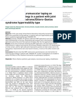 The Effects of Neuromuscular Taping On Gait Walking Strategy in A Patient With Joint Hypermobility syndrome/Ehlers-Danlos Syndrome Hypermobility Type