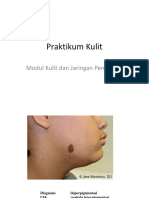 Tentir Prak Kulit