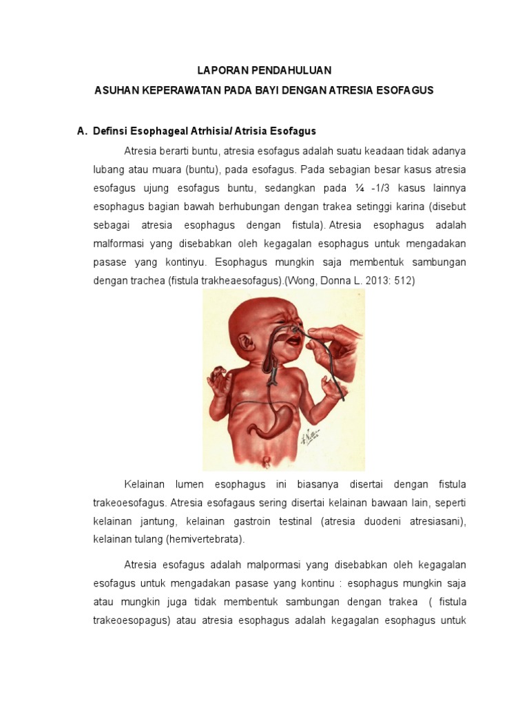 Asuhan Keperawatan Atresia Esofagus Bayi | PDF | Kajian Bahasa Asing ...