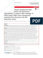 Vicious Circle Between Right Ventricular Dilatation and Pulmonary Regurgitation in TOF Post Repair