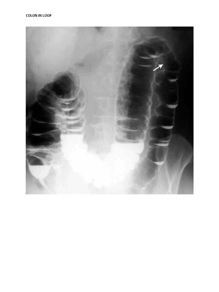Understanding Colon Usage in Loops | PDF