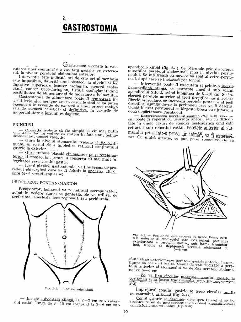 05 Gastrostomia | PDF