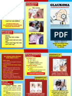 Leaflet Penyuluhan Glaukoma