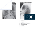 The Normal Frontal Chest Radiograph The Normal Lateral Chest Radiograph