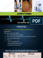 Takiaritmia, Dr. Edi Hidayat, SP - PD