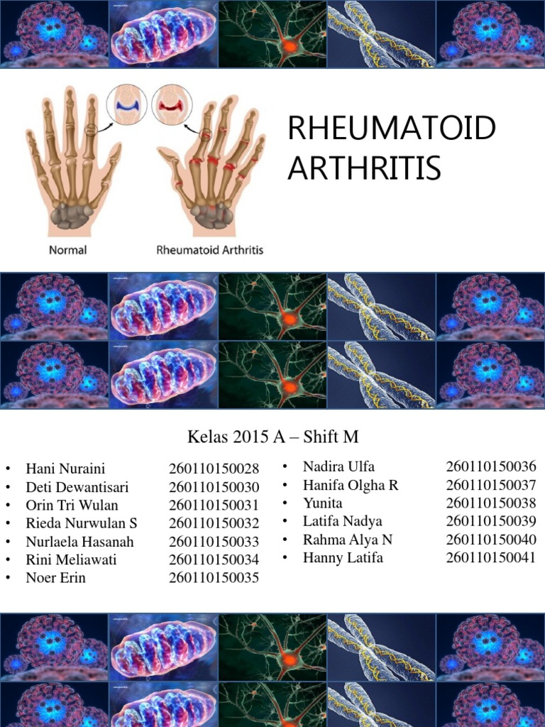 Diagnosa dan Terapi Rheumatoid Arthritis | PDF