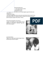 DX TX Volvulus Sigmoid