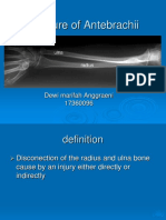 Fracture of Radius, Ulna, and Humerus