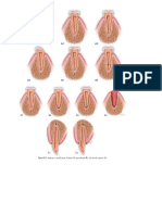 Andreasen Classification