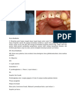 Residual Cyst Upper Jaw 2