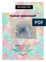 Hawley Modificado Con Eprla-Informe de Odontopediatria Ii