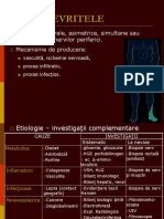 Polinevrite