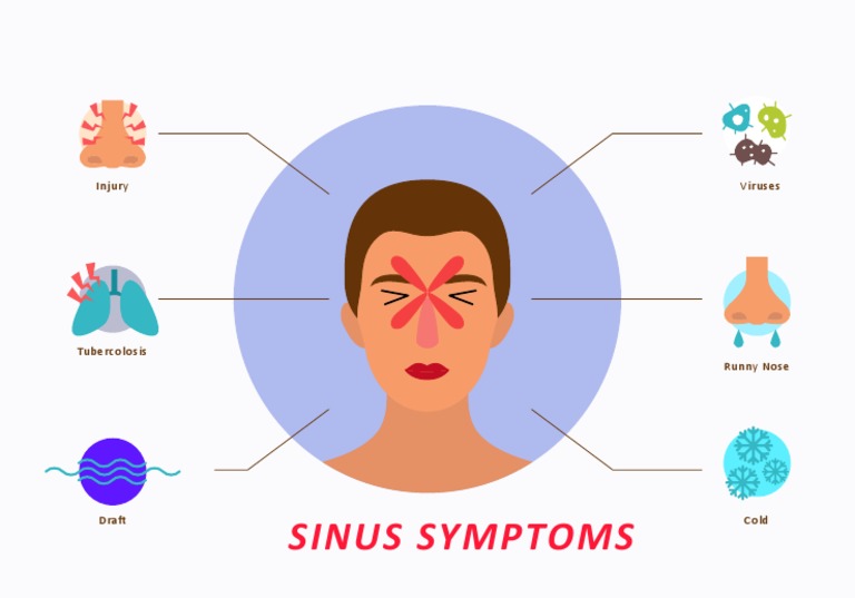 Viruses Injury: Sinus Symptoms | PDF