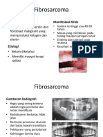 Fibrosarkoma di Mulut