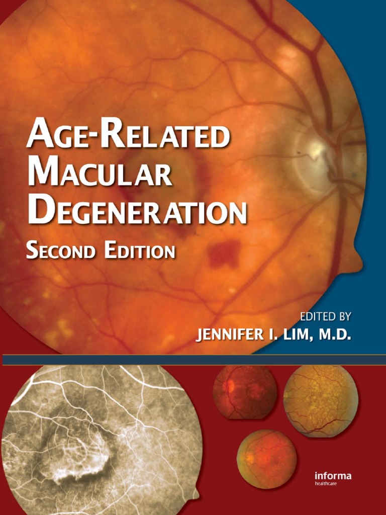 Age-Related Macular Degeneration | PDF | Medicine | Medical Specialties