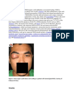 NSOI Has Also Been Observed in Association With A Variety or Rheumatologic Conditions Including Crohn