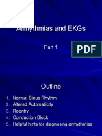 Arrythmias and EKGs 1