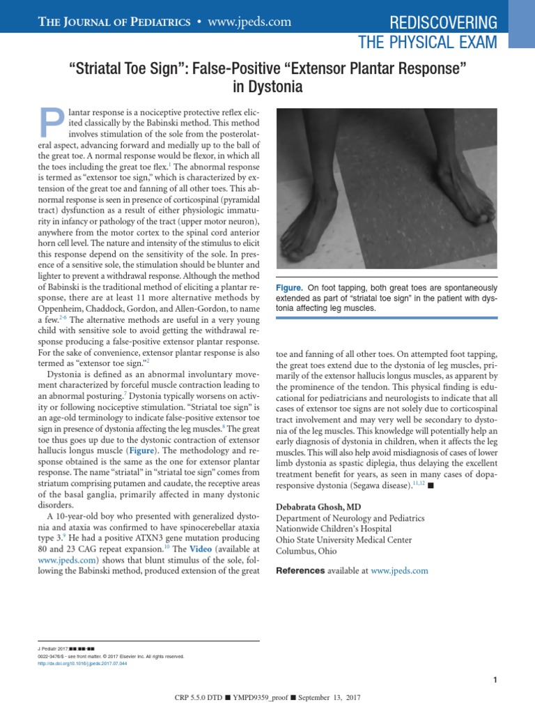 Oppenheim’S Sign : Extensor Plantar Response – EVDENJ